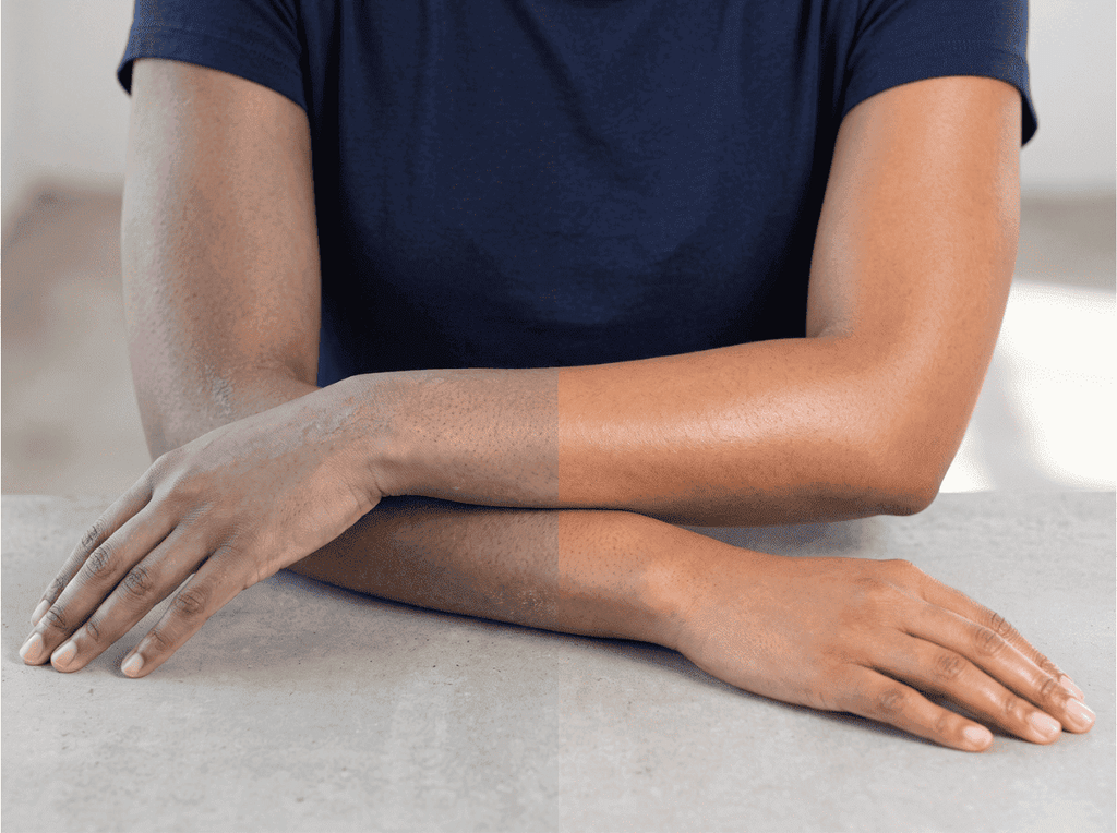 Comparaison peau noire terne et peau noire éclatante après gommage